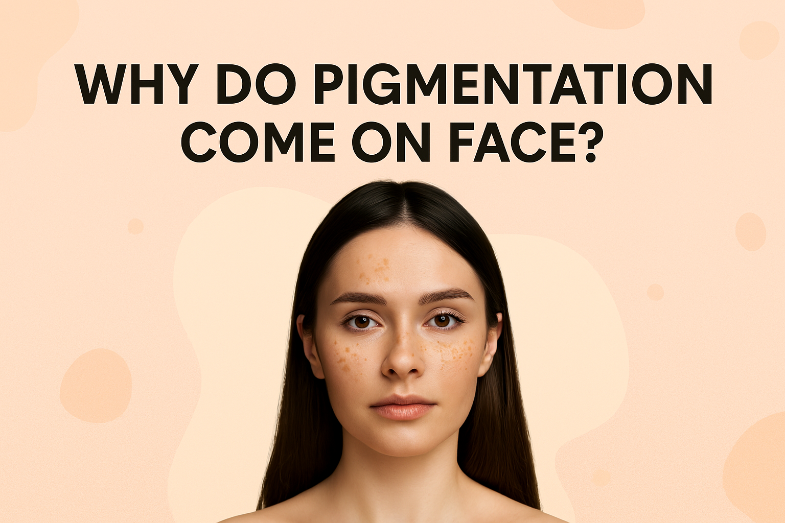 Why Pigmentation Come on Face: Causes, Prevention & Best Solutions