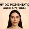 Why Pigmentation Come on Face: Causes, Prevention & Best Solutions