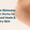 Urea for Cracked Heels & Dry Skin: How & Why It Works?