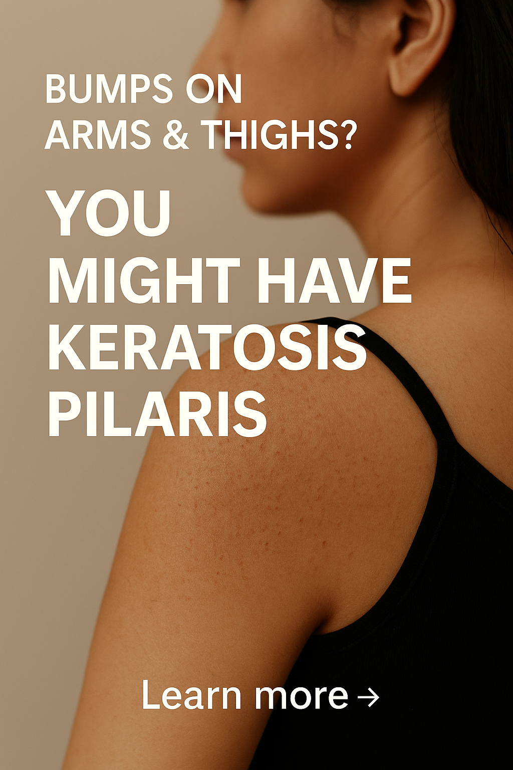 Bumps on Arms & Thighs? You Might Have Keratosis Pilaris (And Yes, It's Treatable)