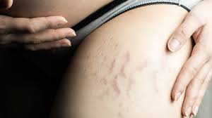 Remedies and Solutions That Actually Work?