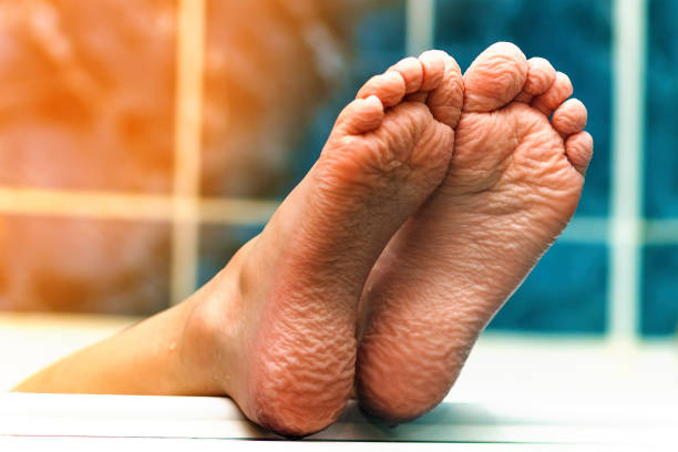 Say Goodbye to Foot Wrinkles and Dead Skin: Here’s Why Your Feet Deserve More Love