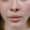 Best Benzoyl Peroxide Body Washes for Back Acne in India (2026 Guide)