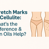 Stretch Marks vs Cellulite: What’s the Difference & Can Oils Help?