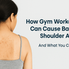 How Gym Workouts Cause Back Acne: Prevention & Skincare Tips