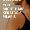Tiny Bumps on Arms or Thighs? It Could Be Keratosis Pilaris| Wildoak