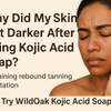 Why Kojic Acid Soap Made My Skin Darker? Causes & Fixes | WildOak