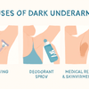 Why Are My Underarms Darker Than the Rest of My Skin? Is It Because of Shaving, My Deodorant, or Something Medical?